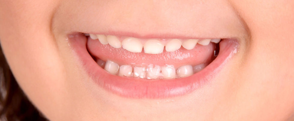 Why does my child grind their teeth at night?