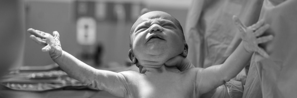 Caesarean birth – a complete guide on what to expect
