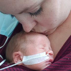 Mother kissing baby with feeding tube